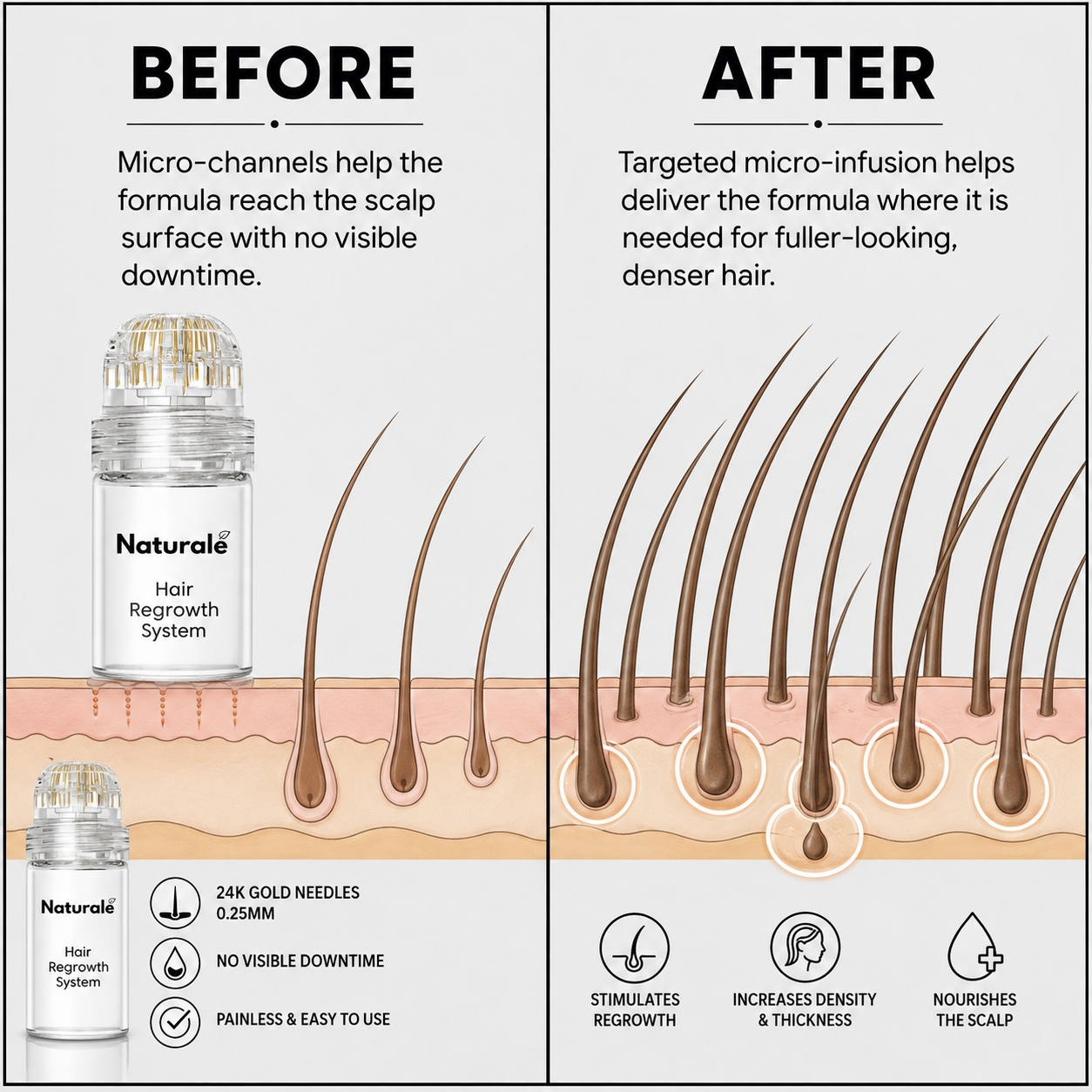 Hair Regrowth System Scalp Stamping Ritual